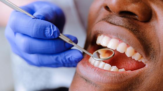 صحة الأسنان تحافظ على الجسم.. اعرف التفاصيل